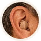 Aparelhos Auditivos em Goiania intra-auricular