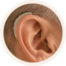 Aparelhos Auditivos em Goiania retroauricular